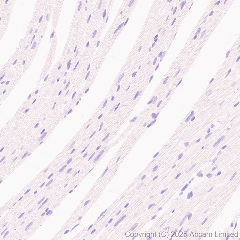 Immunohistochemistry (Formalin/PFA-fixed paraffin-embedded sections) - Anti-MyoD1 antibody [EPR29627-738] (AB323377)
