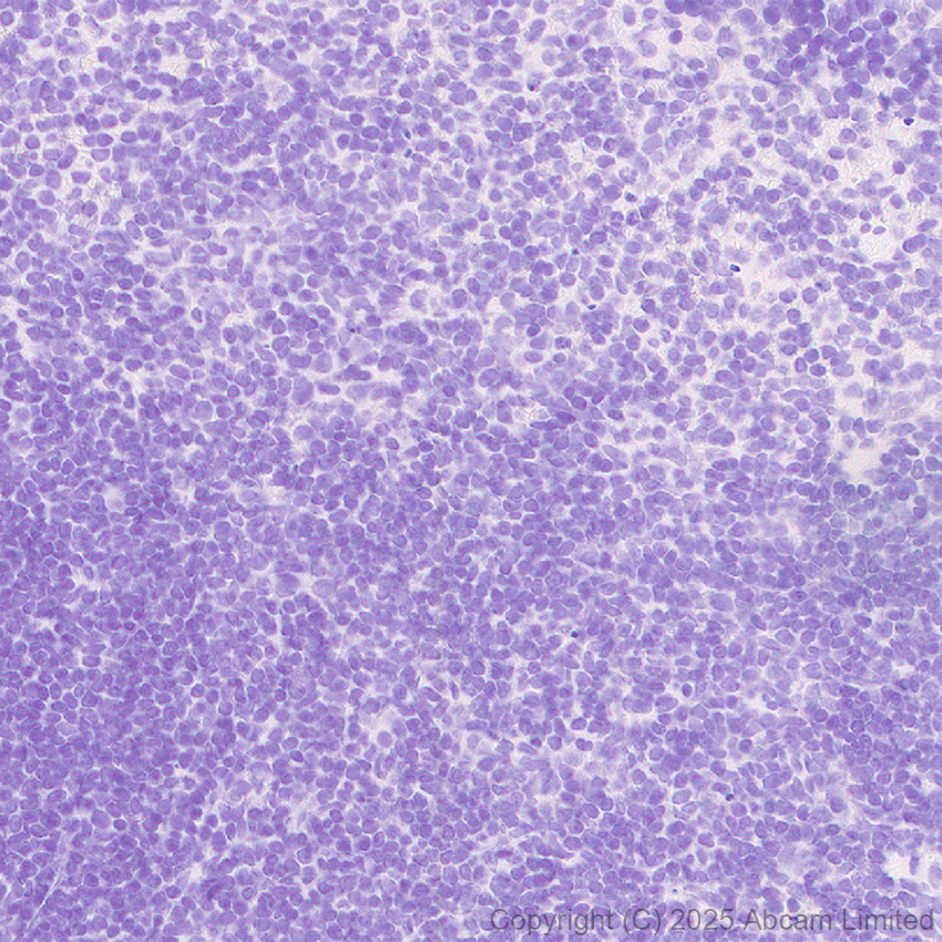 Immunohistochemistry (Formalin/PFA-fixed paraffin-embedded sections) - Anti-MyoD1 antibody [EPR29627-738] (AB323377), expandable thumbnail