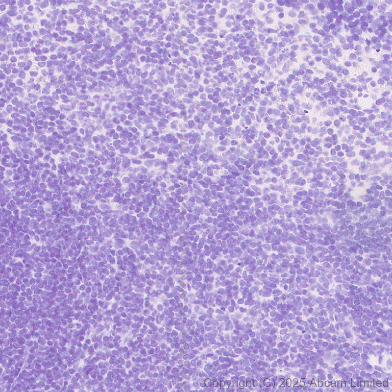 Immunohistochemistry (Formalin/PFA-fixed paraffin-embedded sections) - Anti-MyoD1 antibody [EPR29627-738] (AB323377)