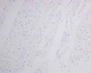 Immunohistochemistry (Formalin/PFA-fixed paraffin-embedded sections) - Anti-MyoD1 antibody [EPR6653-131] (AB133627), expandable thumbnail