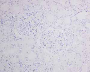 Immunohistochemistry (Formalin/PFA-fixed paraffin-embedded sections) - Anti-MyoD1 antibody [EPR6653-131] (ab133627), expandable thumbnail