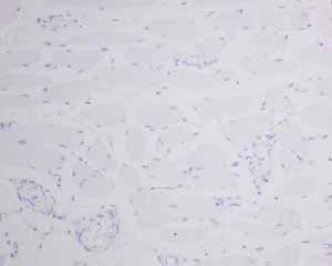 Immunohistochemistry (Formalin/PFA-fixed paraffin-embedded sections) - Anti-MyoD1 antibody [EPR6653-131] (ab133627), expandable thumbnail
