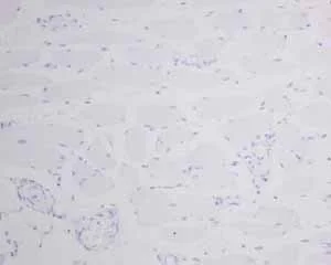 Immunohistochemistry (Formalin/PFA-fixed paraffin-embedded sections) - Anti-MyoD1 antibody [EPR6653-131] (AB133627)