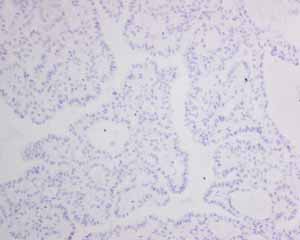 Immunohistochemistry (Formalin/PFA-fixed paraffin-embedded sections) - Anti-MyoD1 antibody [EPR6653-131] (ab133627), expandable thumbnail