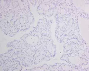 Immunohistochemistry (Formalin/PFA-fixed paraffin-embedded sections) - Anti-MyoD1 antibody [EPR6653-131] (AB133627)