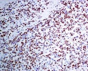 Immunohistochemistry (Formalin/PFA-fixed paraffin-embedded sections) - Anti-MyoD1 antibody [EPR6653-131] (AB133627)