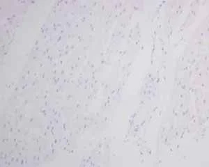 Immunohistochemistry (Formalin/PFA-fixed paraffin-embedded sections) - Anti-MyoD1 antibody [EPR6653-131] - BSA and Azide free (AB240073)