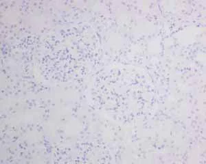 Immunohistochemistry (Formalin/PFA-fixed paraffin-embedded sections) - Anti-MyoD1 antibody [EPR6653-131] - BSA and Azide free (AB240073)