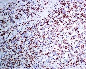 Immunohistochemistry (Formalin/PFA-fixed paraffin-embedded sections) - Anti-MyoD1 antibody [EPR6653-131] - BSA and Azide free (AB240073)