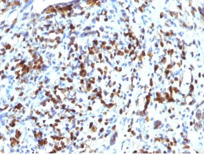 Immunohistochemistry (Formalin/PFA-fixed paraffin-embedded sections) - Anti-MyoD1 antibody [MYOD1/2075R] (AB238026)