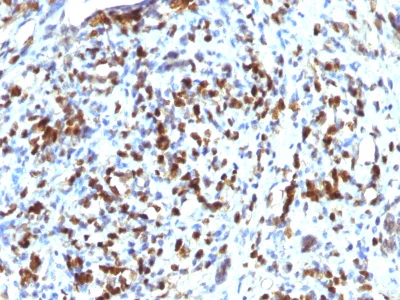 Immunohistochemistry (Formalin/PFA-fixed paraffin-embedded sections) - Anti-MyoD1 antibody [MYOD1/2075R] - BSA and Azide free (AB237870)