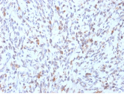 Immunohistochemistry (Formalin/PFA-fixed paraffin-embedded sections) - Anti-MyoD1 antibody [rMYD712] (AB238025)