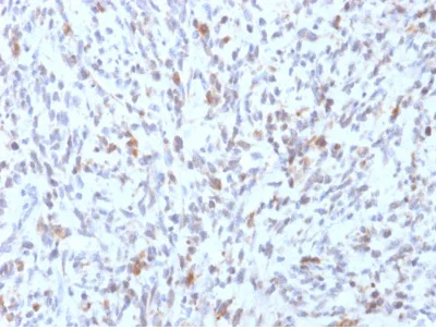 Immunohistochemistry (Formalin/PFA-fixed paraffin-embedded sections) - Anti-MyoD1 antibody [rMYD712] (AB238025)