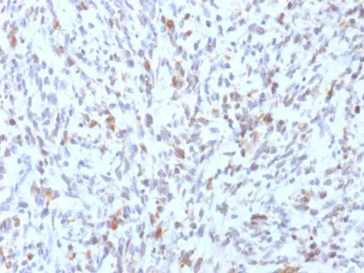 Immunohistochemistry (Formalin/PFA-fixed paraffin-embedded sections) - Anti-MyoD1 antibody [rMYD712] - BSA and Azide free (AB237869)