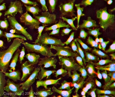 Immunocytochemistry/ Immunofluorescence - Anti-Myoferlin antibody [7D2] (AB76746)
