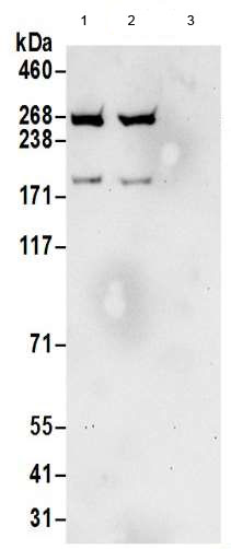 Immunoprecipitation - Anti-Myoferlin antibody (AB190264)