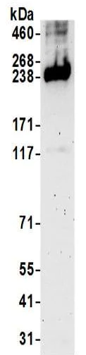 Western blot - Anti-Myoferlin antibody (AB190264)