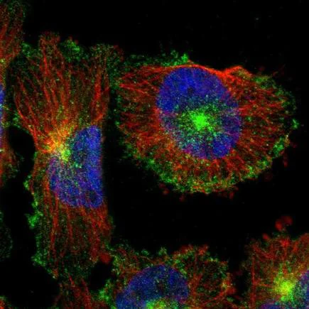 Immunocytochemistry/ Immunofluorescence - Anti-Myoferlin antibody (AB224091)