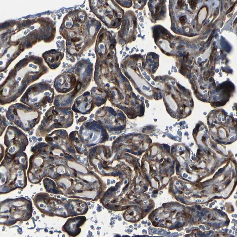 Immunohistochemistry (Formalin/PFA-fixed paraffin-embedded sections) - Anti-Myoferlin antibody (AB224091)