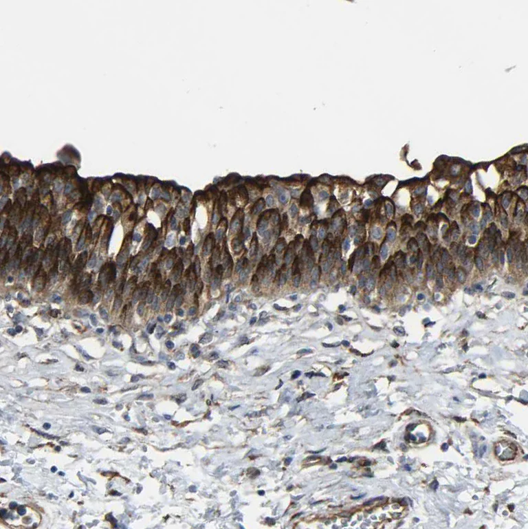 Immunohistochemistry (Formalin/PFA-fixed paraffin-embedded sections) - Anti-Myoferlin antibody (AB224091)