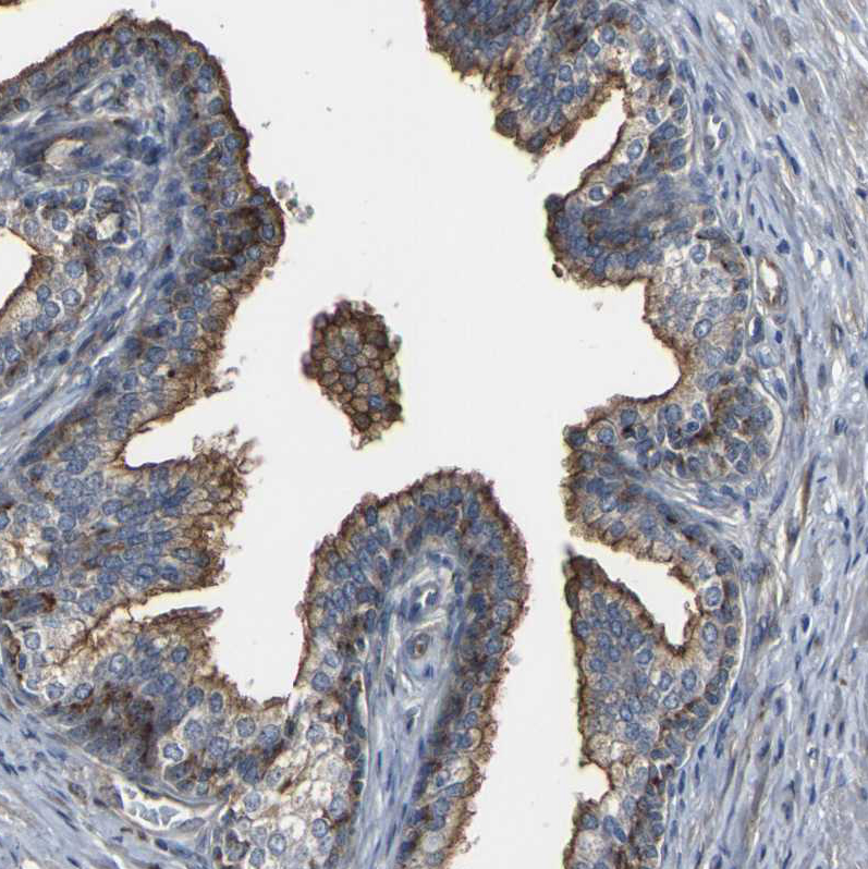 Immunohistochemistry (Formalin/PFA-fixed paraffin-embedded sections) - Anti-Myoferlin antibody (AB224091)