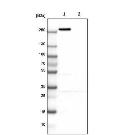 Western blot - Anti-Myoferlin antibody (AB224091)