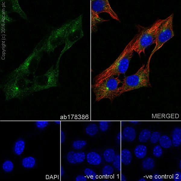 Immunocytochemistry/ Immunofluorescence - Anti-Myoferlin antibody [EPR18887] (AB178386)