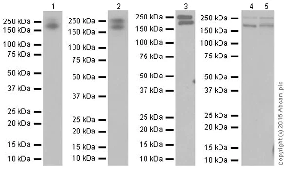 Western blot - Anti-Myoferlin antibody [EPR18887] (AB178386)
