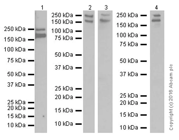 Western blot - Anti-Myoferlin antibody [EPR18887] (AB178386)