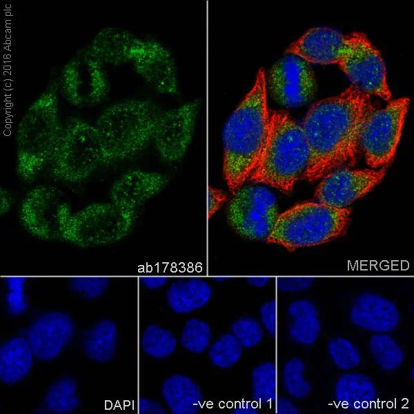 Immunocytochemistry/ Immunofluorescence - Anti-Myoferlin antibody [EPR18887] - BSA and Azide free (AB271928)