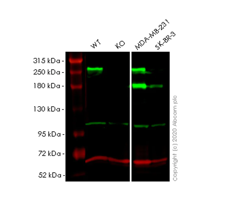 Western blot - Anti-Myoferlin antibody [EPR18887] - BSA and Azide free (AB271928)