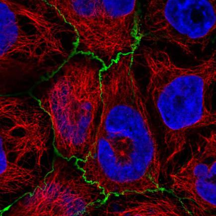 Immunocytochemistry/ Immunofluorescence - Anti-MyoGEF antibody (AB220961)