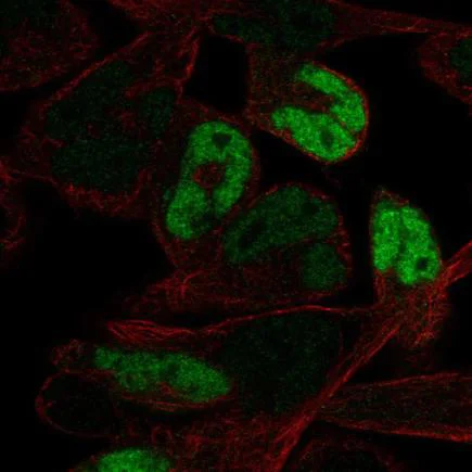 Immunocytochemistry/ Immunofluorescence - Anti-Myogenin antibody (AB219998)