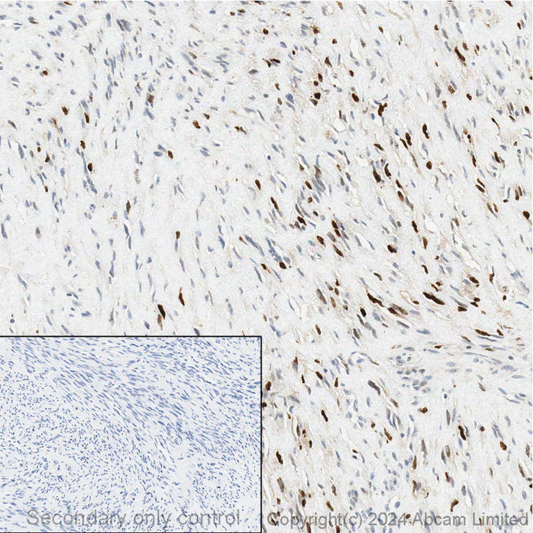 Immunohistochemistry (Formalin/PFA-fixed paraffin-embedded sections) - Anti-Myogenin antibody [EPR4789] (AB124800)