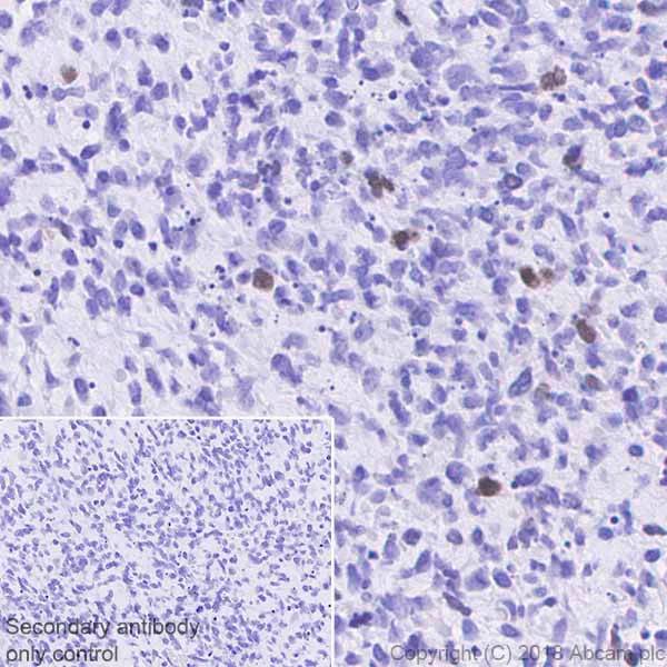 Immunohistochemistry (Formalin/PFA-fixed paraffin-embedded sections) - Anti-Myogenin antibody [EPR4789] (AB124800)