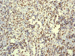 Immunohistochemistry (Formalin/PFA-fixed paraffin-embedded sections) - Anti-Myogenin antibody [EPR4789] - BSA and Azide free (AB232558)