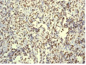 Immunohistochemistry (Formalin/PFA-fixed paraffin-embedded sections) - Anti-Myogenin antibody [EPR4789] - BSA and Azide free (AB232558)