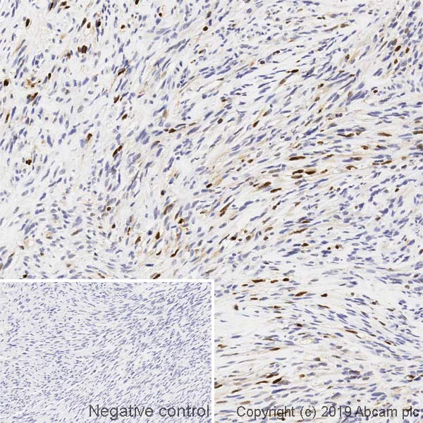 Immunohistochemistry (Formalin/PFA-fixed paraffin-embedded sections) - Anti-Myogenin antibody [F5D] (AB1835)