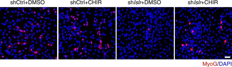 Immunohistochemistry - Anti-Myogenin antibody [F5D] (AB1835)
