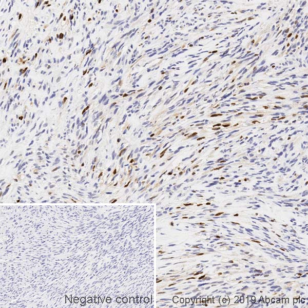 Immunohistochemistry (Formalin/PFA-fixed paraffin-embedded sections) - Anti-Myogenin antibody [F5D] - BSA and Azide free (AB264517)