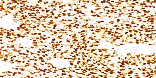 Immunohistochemistry (Formalin/PFA-fixed paraffin-embedded sections) - Anti-Myogenin antibody [MGN185] (AB187373), expandable thumbnail