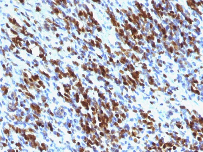 Immunohistochemistry (Formalin/PFA-fixed paraffin-embedded sections) - Anti-Myogenin antibody [MGN185 + F5D] (AB199017)