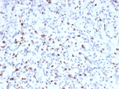 Immunohistochemistry (Formalin/PFA-fixed paraffin-embedded sections) - Anti-Myogenin antibody [MYOG/2660] (AB238027), expandable thumbnail