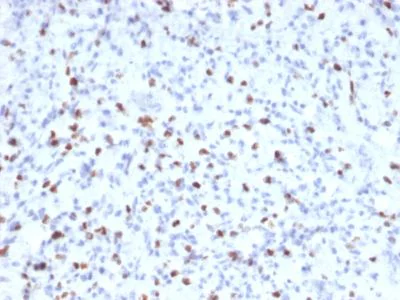 Immunohistochemistry (Formalin/PFA-fixed paraffin-embedded sections) - Anti-Myogenin antibody [MYOG/2660] (AB238027)