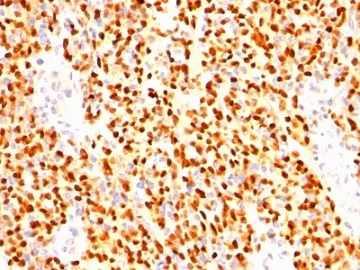 Immunohistochemistry (Formalin/PFA-fixed paraffin-embedded sections) - Anti-Myogenin antibody [SPM144] (AB233943)
