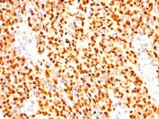 Immunohistochemistry (Formalin/PFA-fixed paraffin-embedded sections) - Anti-Myogenin antibody [SPM144] - BSA and Azide free (AB212668)