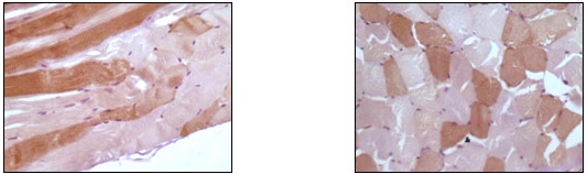 Immunohistochemistry (Formalin/PFA-fixed paraffin-embedded sections) - Anti-Myoglobin antibody [6H8B5] (AB47702), expandable thumbnail