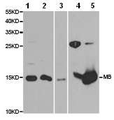 Western blot - Anti-Myoglobin antibody (AB187506), expandable thumbnail