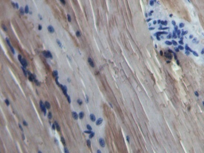 Immunohistochemistry (Formalin/PFA-fixed paraffin-embedded sections) - Anti-Myoglobin antibody (AB231530), expandable thumbnail