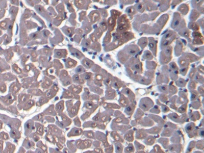Immunohistochemistry (Formalin/PFA-fixed paraffin-embedded sections) - Anti-Myoglobin antibody (AB231530), expandable thumbnail